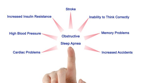 Obstructive Sleep Apnea - What You Need to Know About Causes and Treatment